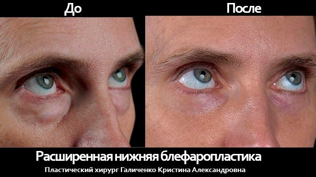Галиченко Кристина