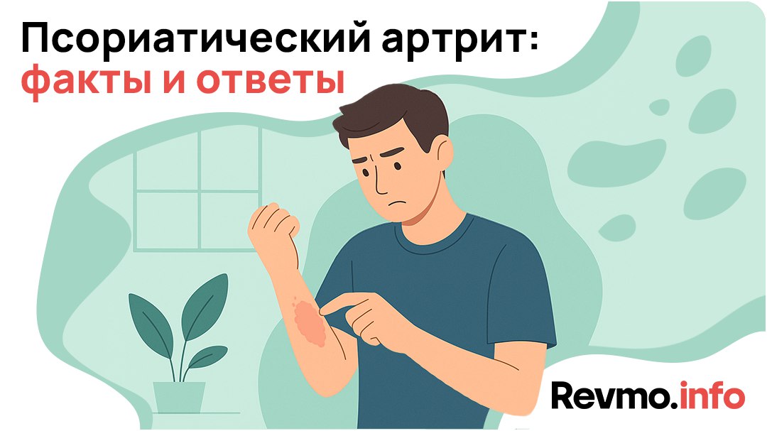 Revmo.info — Ревматоидный, аксиальный спондило- и псориатический артрит, системная склеродермия